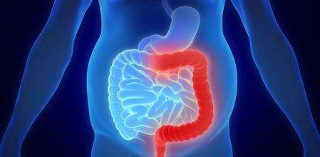 Tratamiento de la colitis severa y fulminante