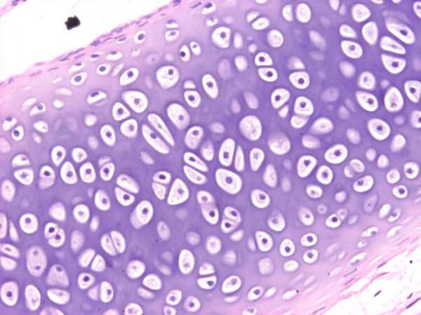 Hidratación de la matriz del cartílago hialino