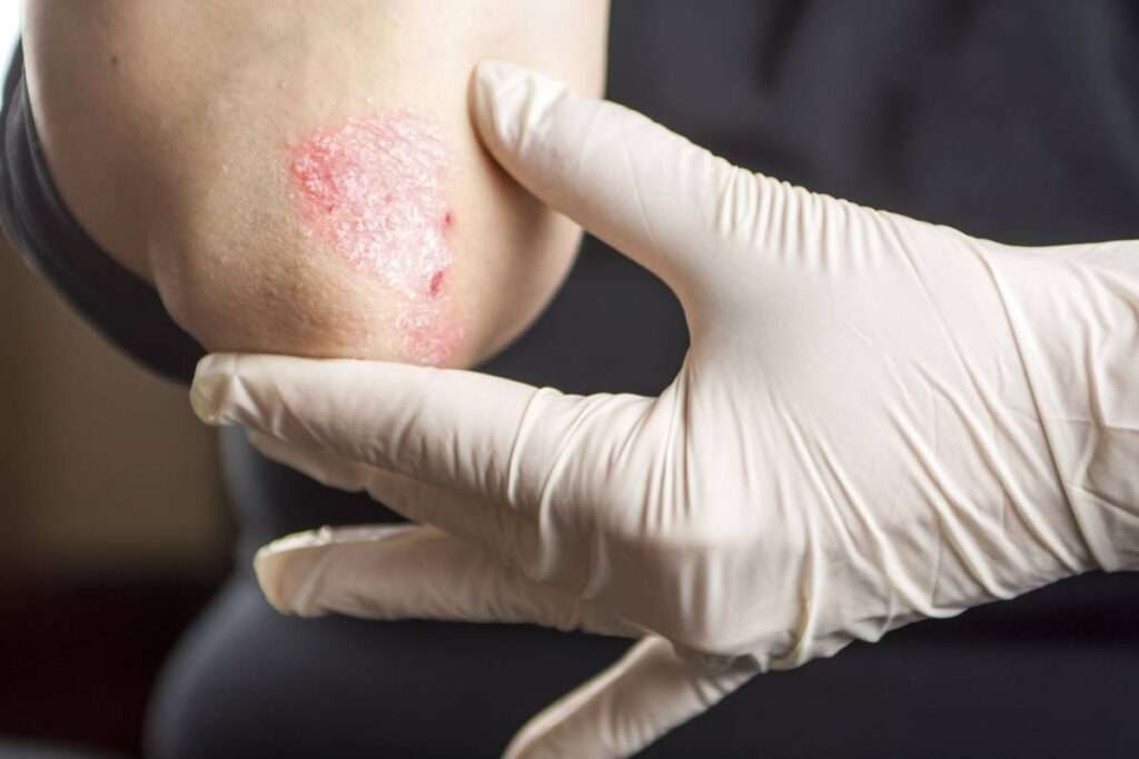 Manifestaciones reumatológicas del cáncer