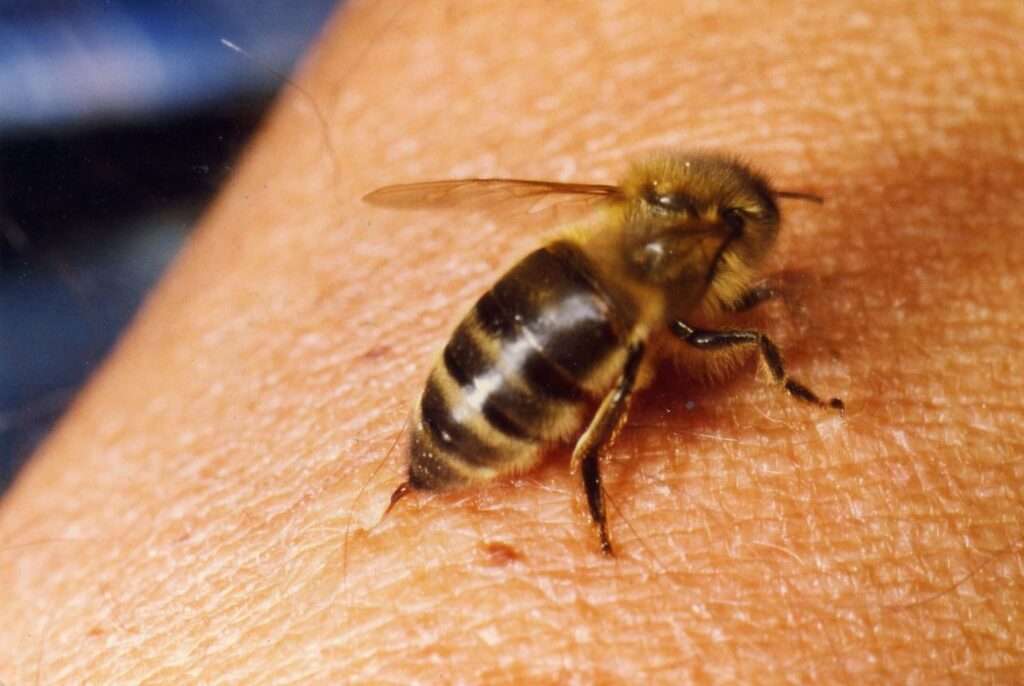 ¿Qué es la alergia al veneno?