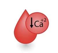 Hipocalcemia