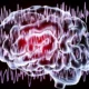 Tipos de convulsiones epilépticas