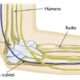 Lesiones del nervio cubital