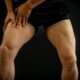 ¿Qué es la Neuropatía Femoral?