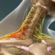 Síndrome de la costilla cervical