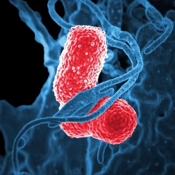 Trastornos de la transmisión neuromuscular debido a la toxina de Clostridium botulinum