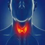 Causas de hipertiridoidismo