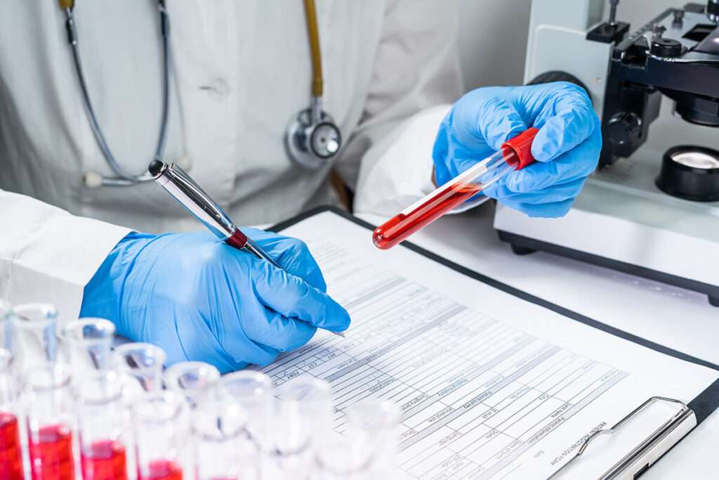 Hallazgos de laboratorio en la diabetes mellitus