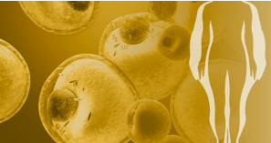 Trastornos lipídicos