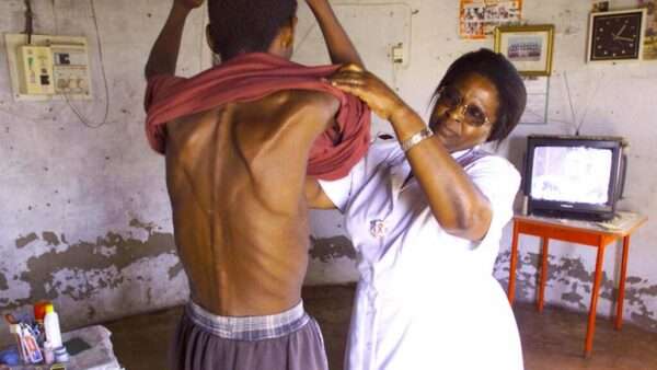 Manifestaciones Sistémicas en Personas con VIH