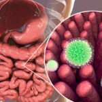 Gastroenteritis causada por virus
