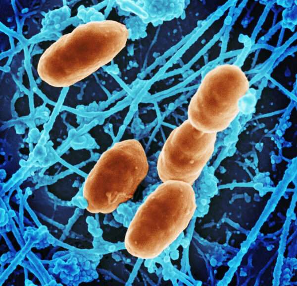 El tifus endémico (murino)