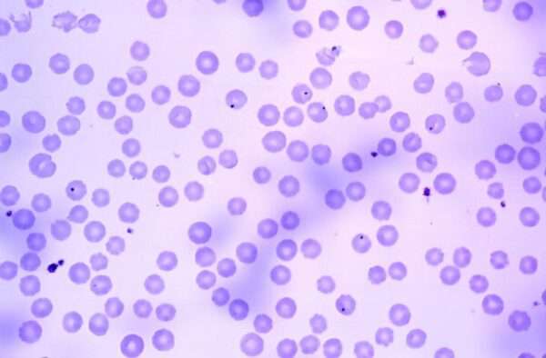 Ehrlichiosis y Anaplasmosis