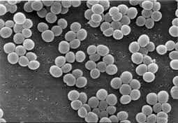 Infecciones causadas por estafilococos coagulasa-negativos