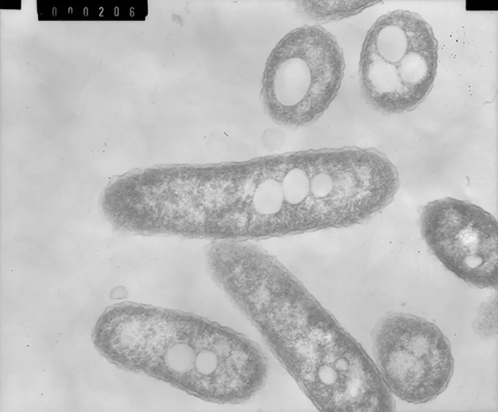 Infección por Bordetella pertussis (tos ferina)