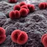 Meningitis meningocócica