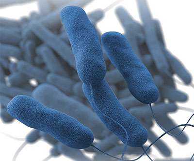Enfermedad por Legionella