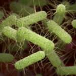 Fiebre tifoidea (fiebre entérica)