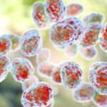 Tularemia