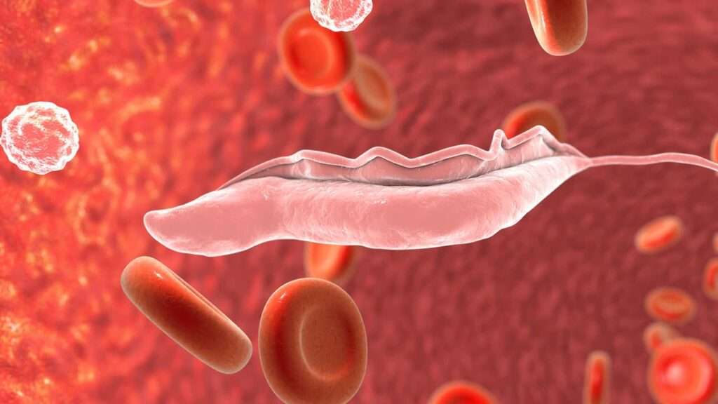 Tripanosomiasis africana (Enfermedad del Sueño)