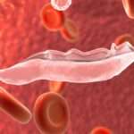 Tripanosomiasis africana (Enfermedad del Sueño)