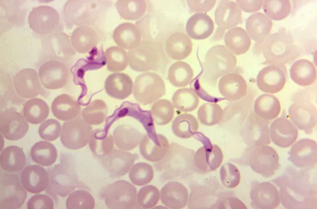 Trypanosomiasis americana (Enfermedad de Chagas)