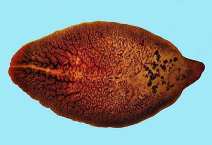 Fasciolasis