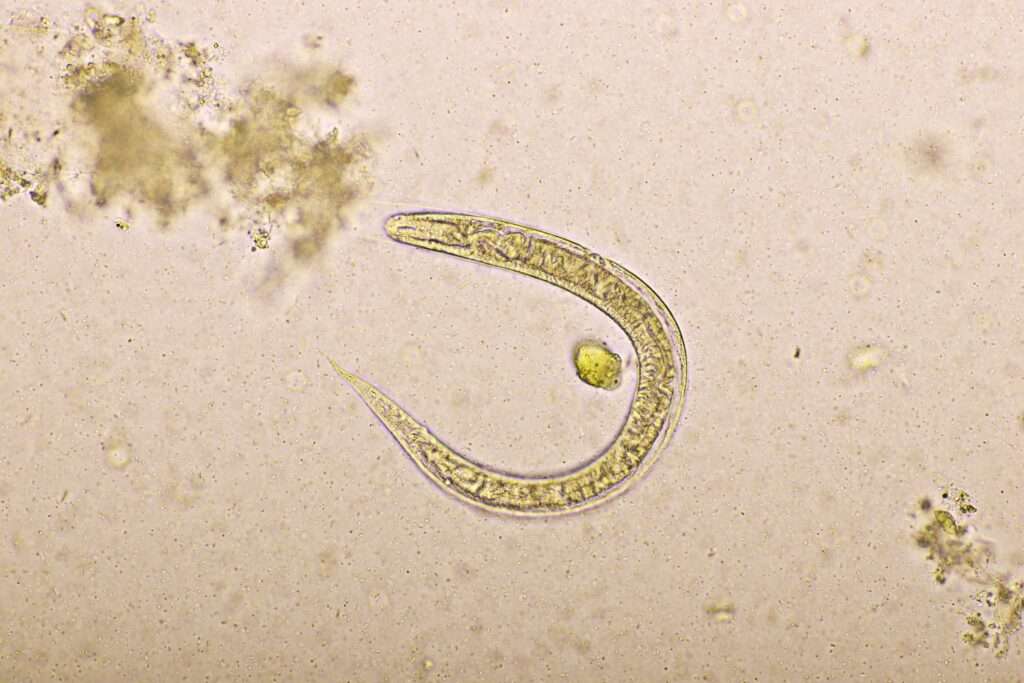Estrongiloidiasis