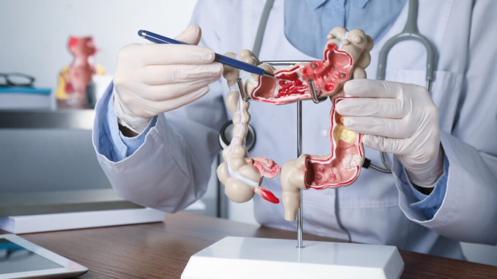 Tratamiento del cáncer colorrectal