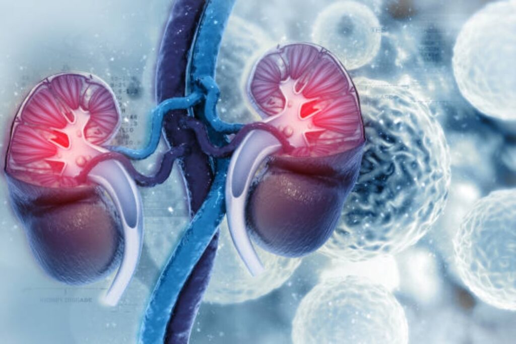 Cánceres del uréter y de la pélvis renal