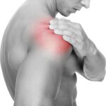 Desgarros del manguito rotador