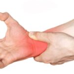 Síndrome del túnel carpiano