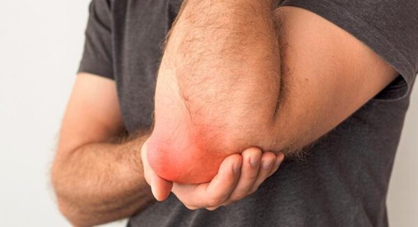 Bursitis