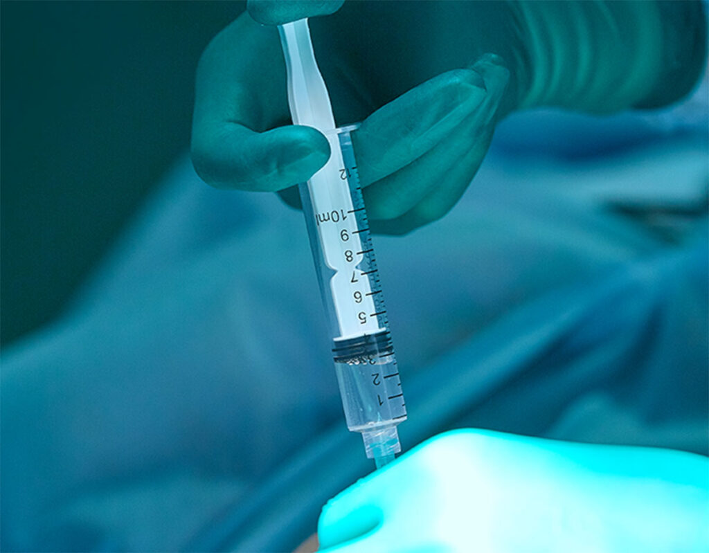 Intoxicación por anestésicos locales