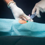 Ventajas y desventajas de la anestesia regional