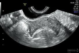 Desarrollo histórico de distintas técnicas ecocardiográficas