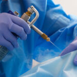 Criocirugía en lesiones cutáneas