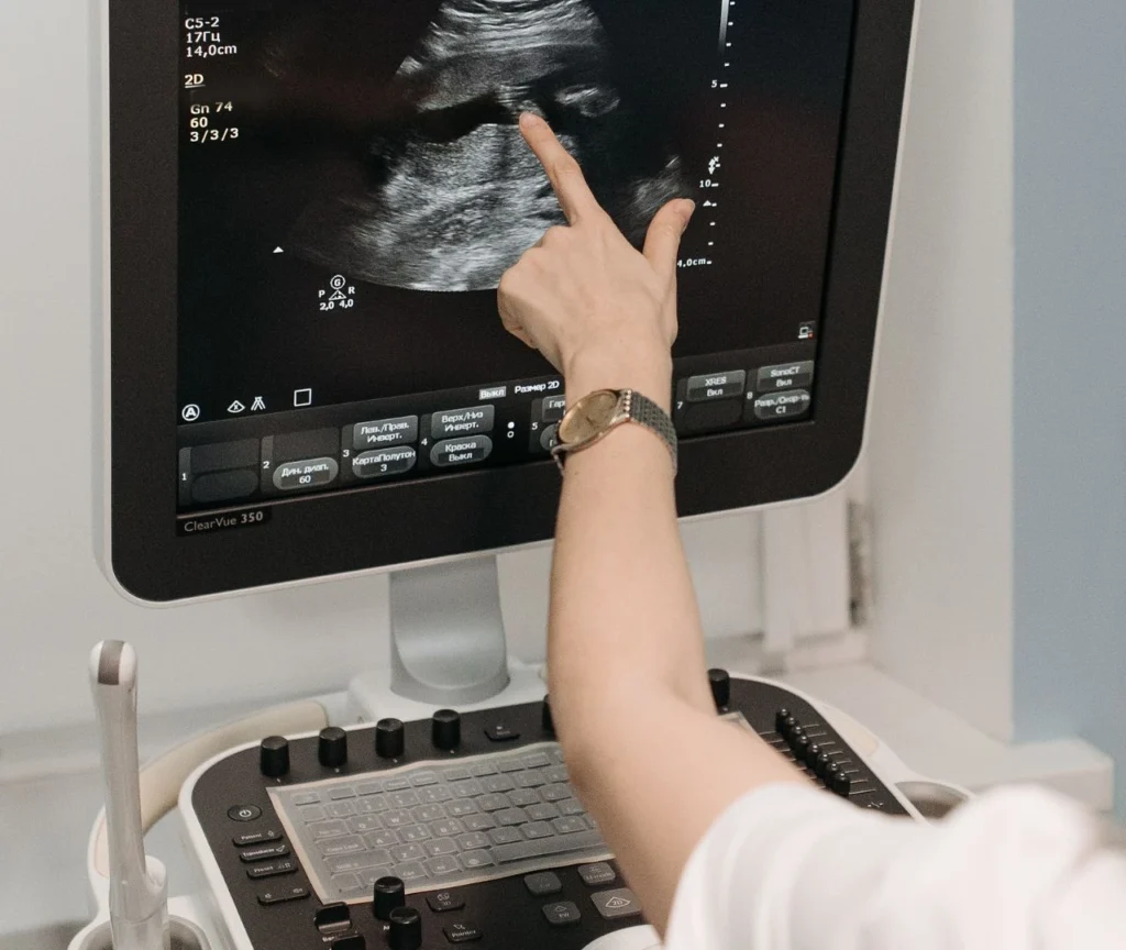 Interacción de los Ultrasonidos con los Tejidos y su Aplicación en Ecografía