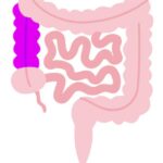 Colon ascendente y flexura cólica derecha