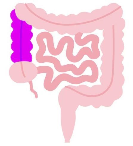 Colon ascendente y flexura cólica derecha