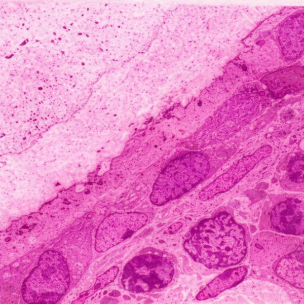 Origen y potencial de diferenciación de las células osteoprogenitoras