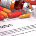 Tratamientos estándar en el lupus eritematoso sistémico