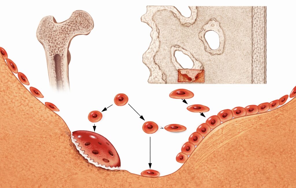 ¿Qué es el modelado óseo?