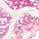 Formación de tejido óseo