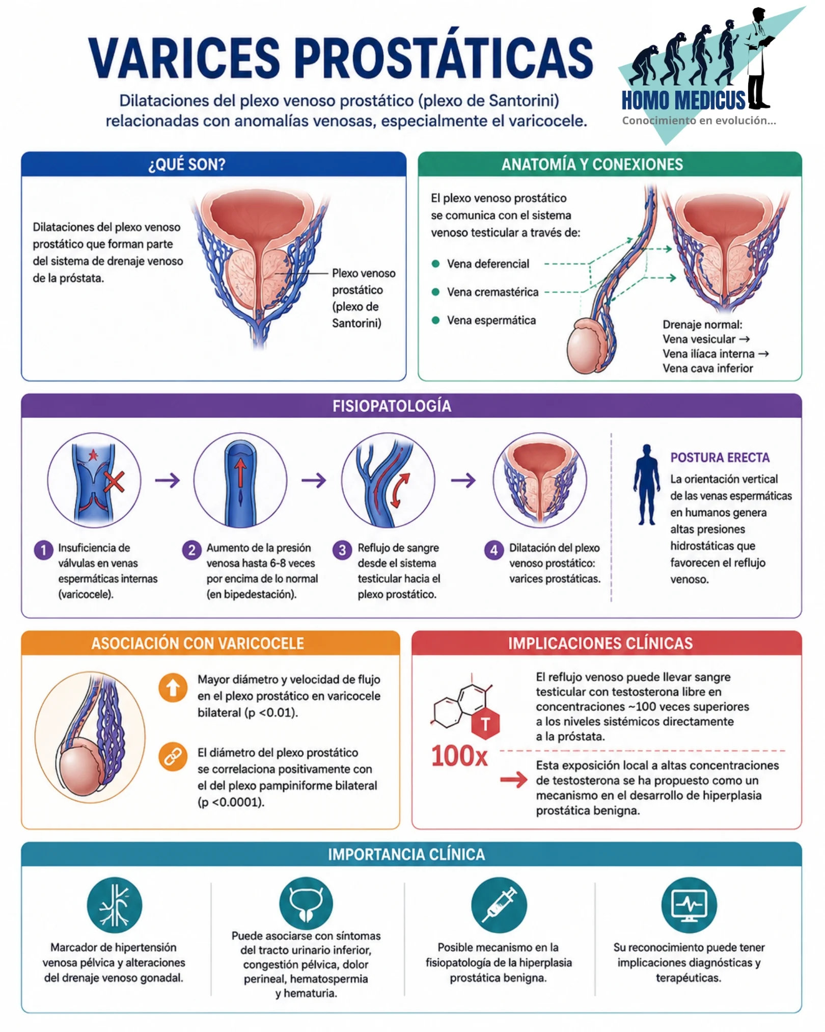 VARICES PROSTÁTICAS
