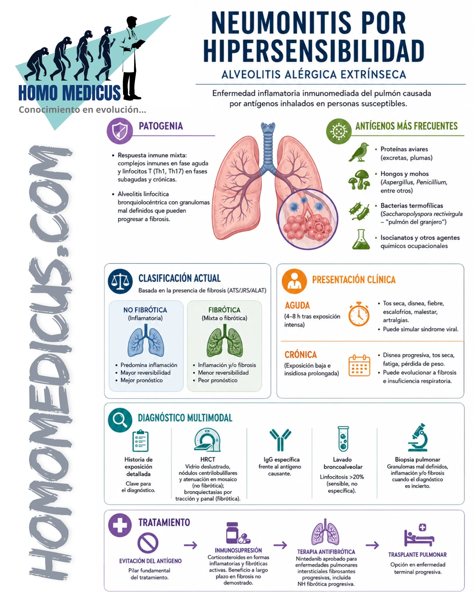 Alveolitis por hipersensivilidad Alveolitis por hipersensivilidad