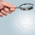 Cribado del cáncer colorrectal. Estrategias, pruebas diagnósticas y criterios para la selección según el riesgo individual.